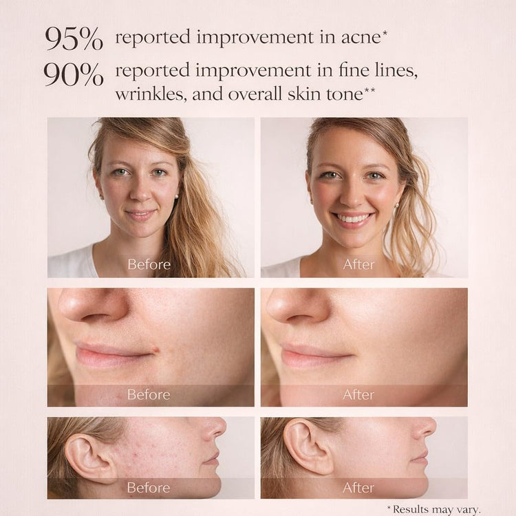 Halo LED Facial Glowing Mask