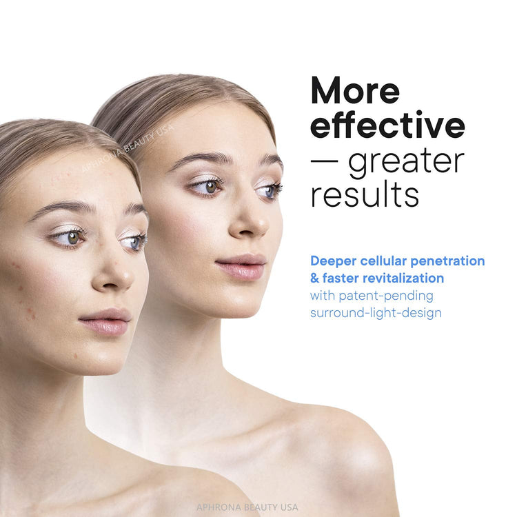 Moonlight LED Facial Treatment Mask 3-Color