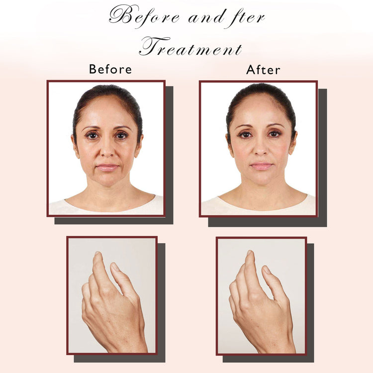 Avorla® Golden Glow Facial Brightening Wand