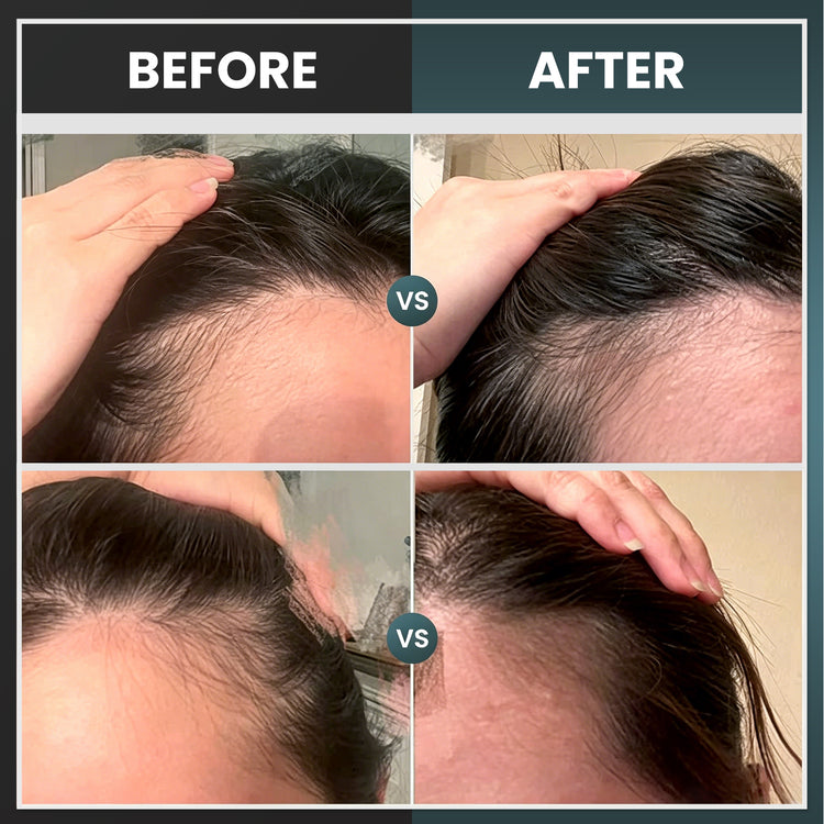 Hair Regrowth Cap (UPC 686294359279)