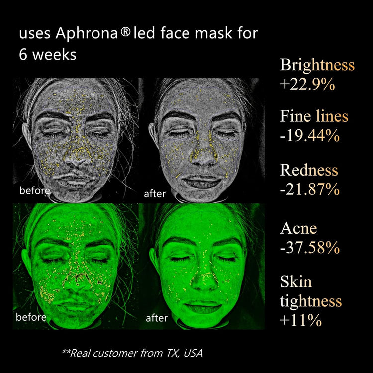 Halo LED Facial Glowing Mask