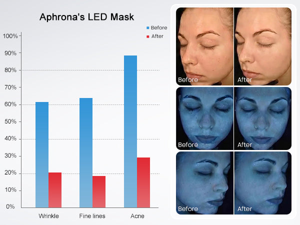 Moonlight LED Facial Treatment Mask 3-Color