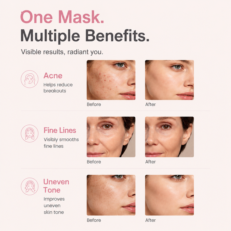 Avorla Beauty LED Silicone Facial Treatment Mask 7-Color