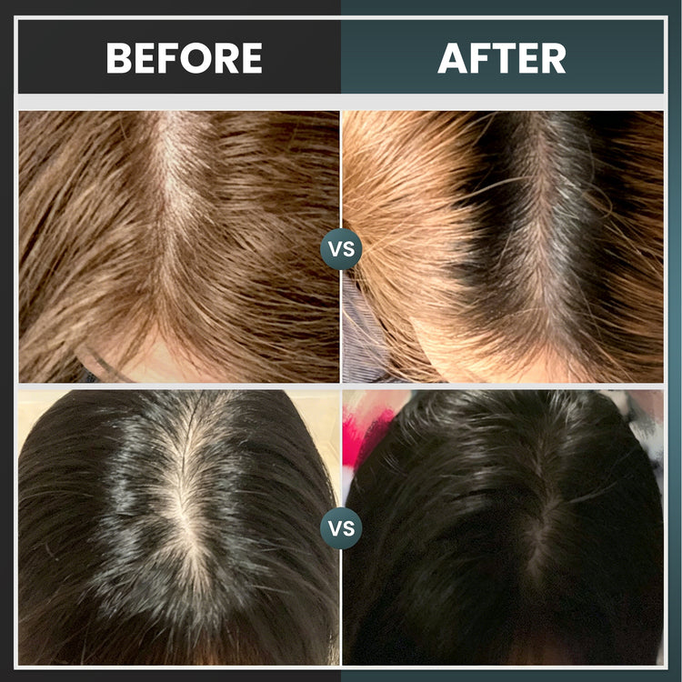 Hair Regrowth Cap (UPC 686294359279)