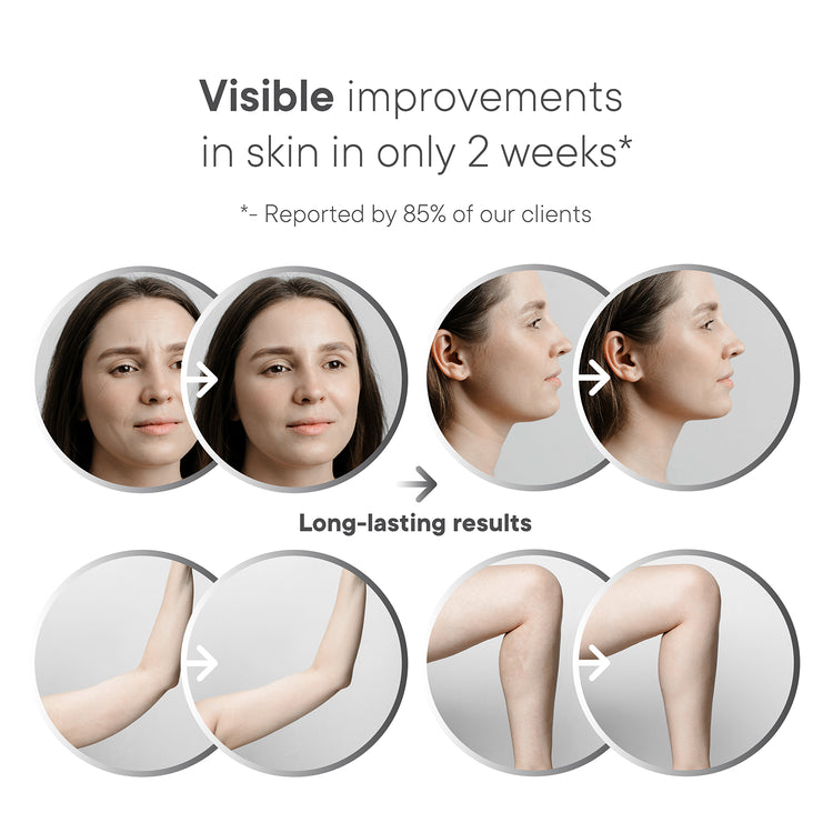 Avorla® SuperNova Skin Tightening